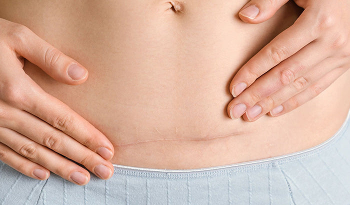 A woman in a crop top showing her midriff